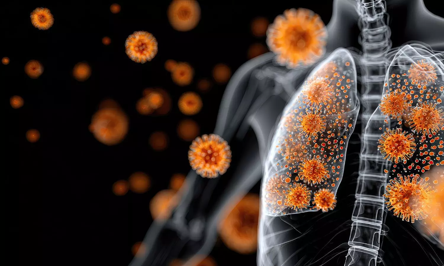 Experts urge hospitals to adopt coordinated strategies for infection control