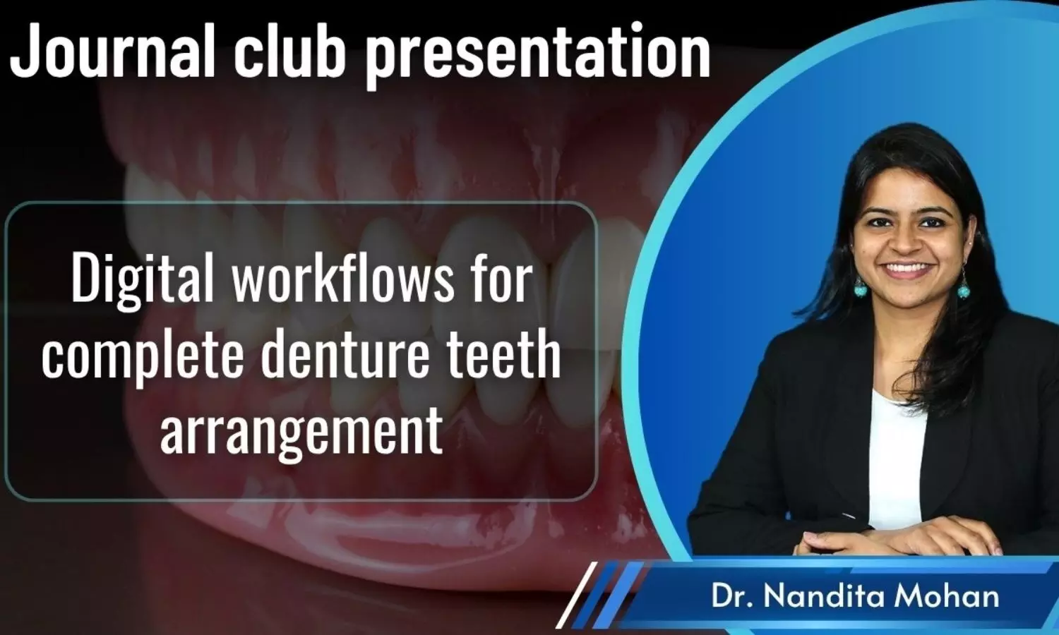 Journal Club-Digital workflows for complete denture teeth arrangement