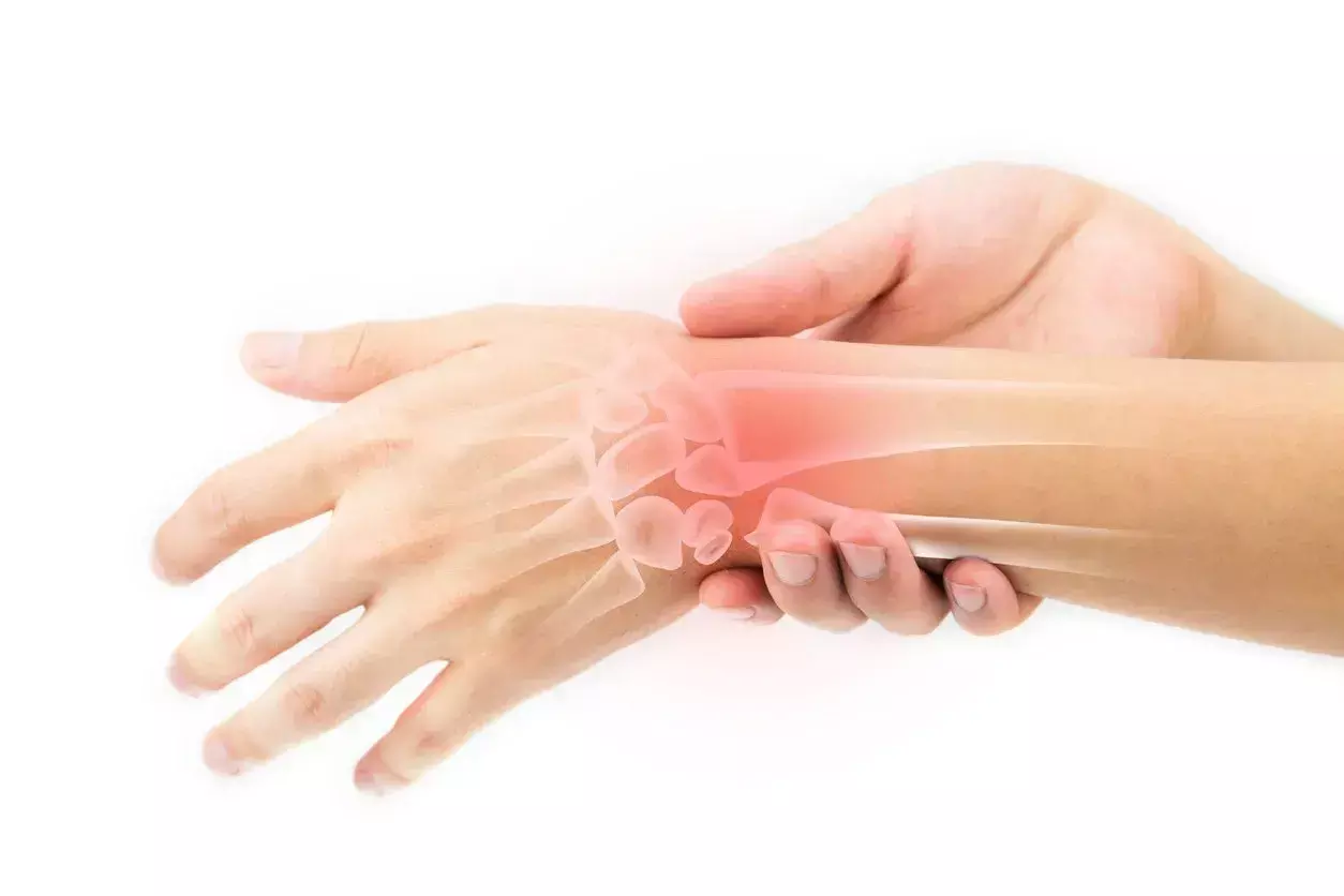 Fibular Graft Reconstruction Shows Good Outcomes in Distal Radius Giant cell tumors: study Fibular Graft Reconstruction Shows Good Outcomes in Distal Radius Giant cell tumors: study