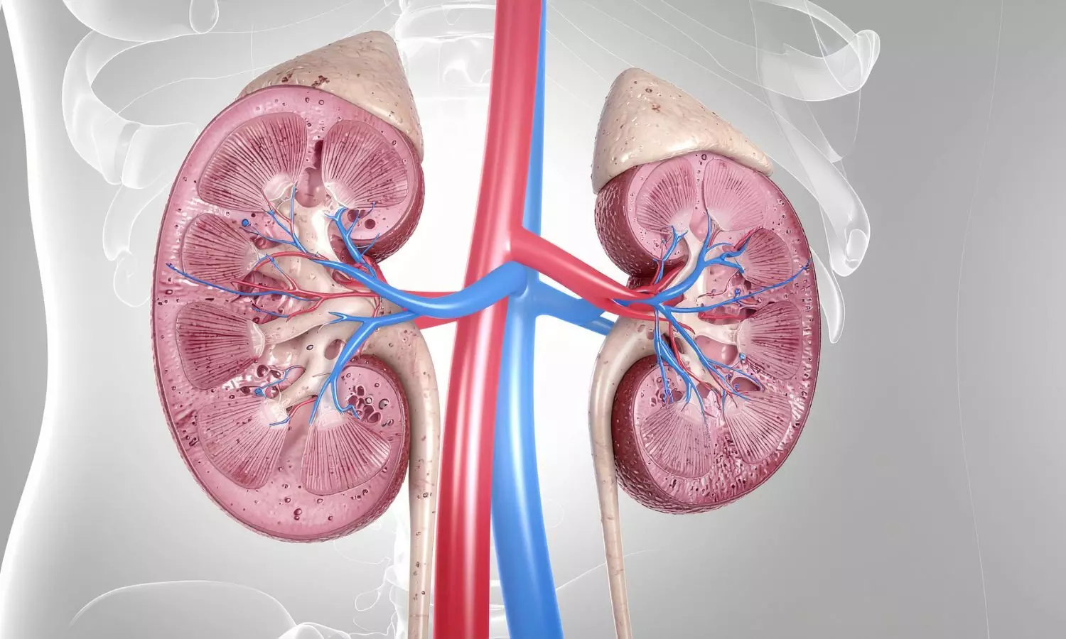 66-year-old Patient Receives Human Kidney Transplant After 271 Days With Pig Kidney 66-year-old Patient Receives Human Kidney Transplant After 271 Days With Pig Kidney