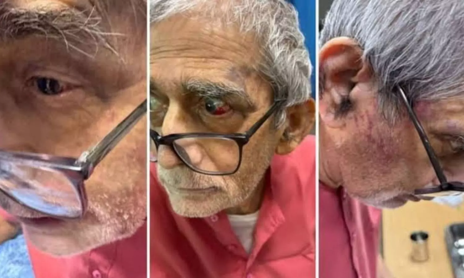 Padma Shri Prof T K Lahiri denies assault allegation at BHU hospital, probe underway