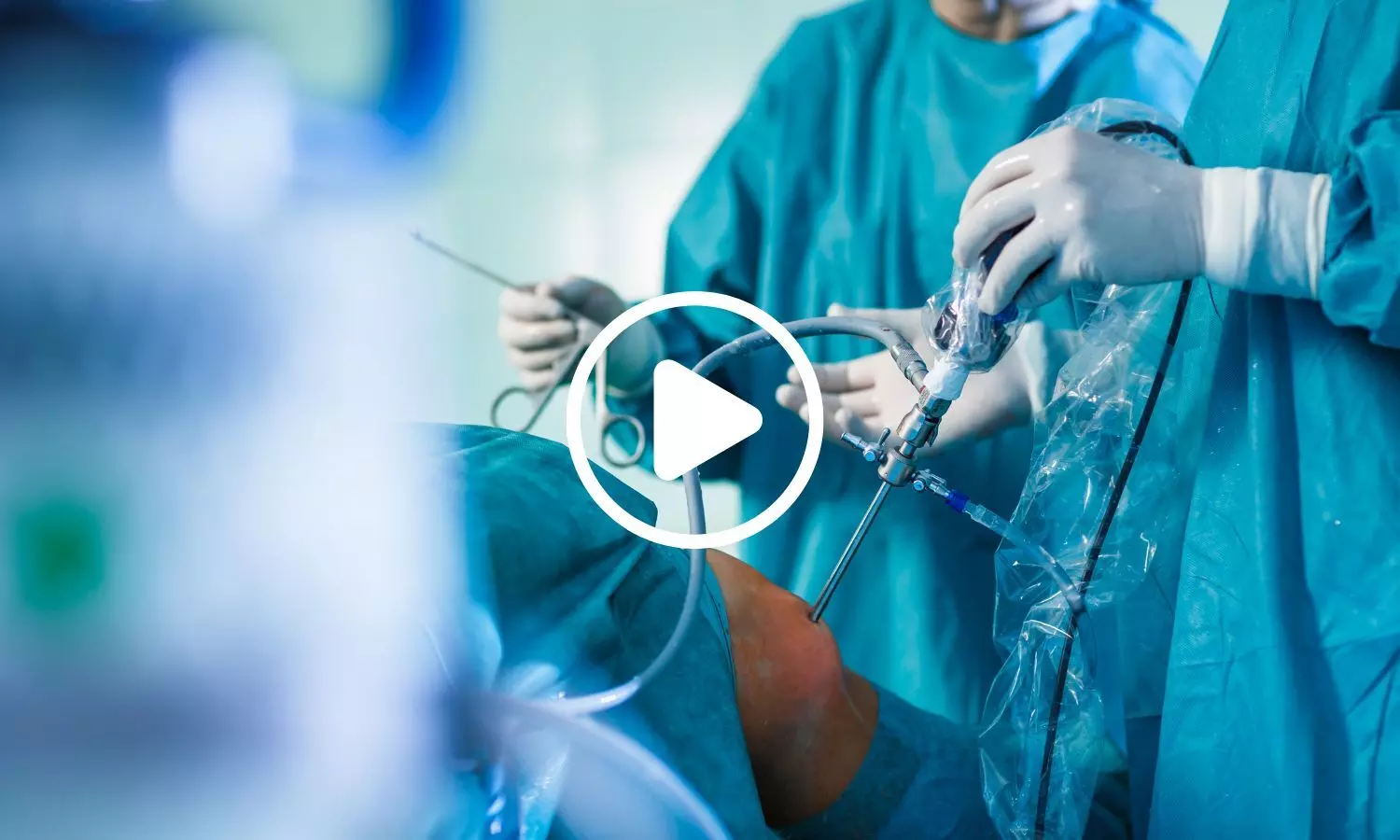Bariatric Surgery Linked to Restored Menstrual Cycles and Fewer Polycystic Ovaries in Women: Study