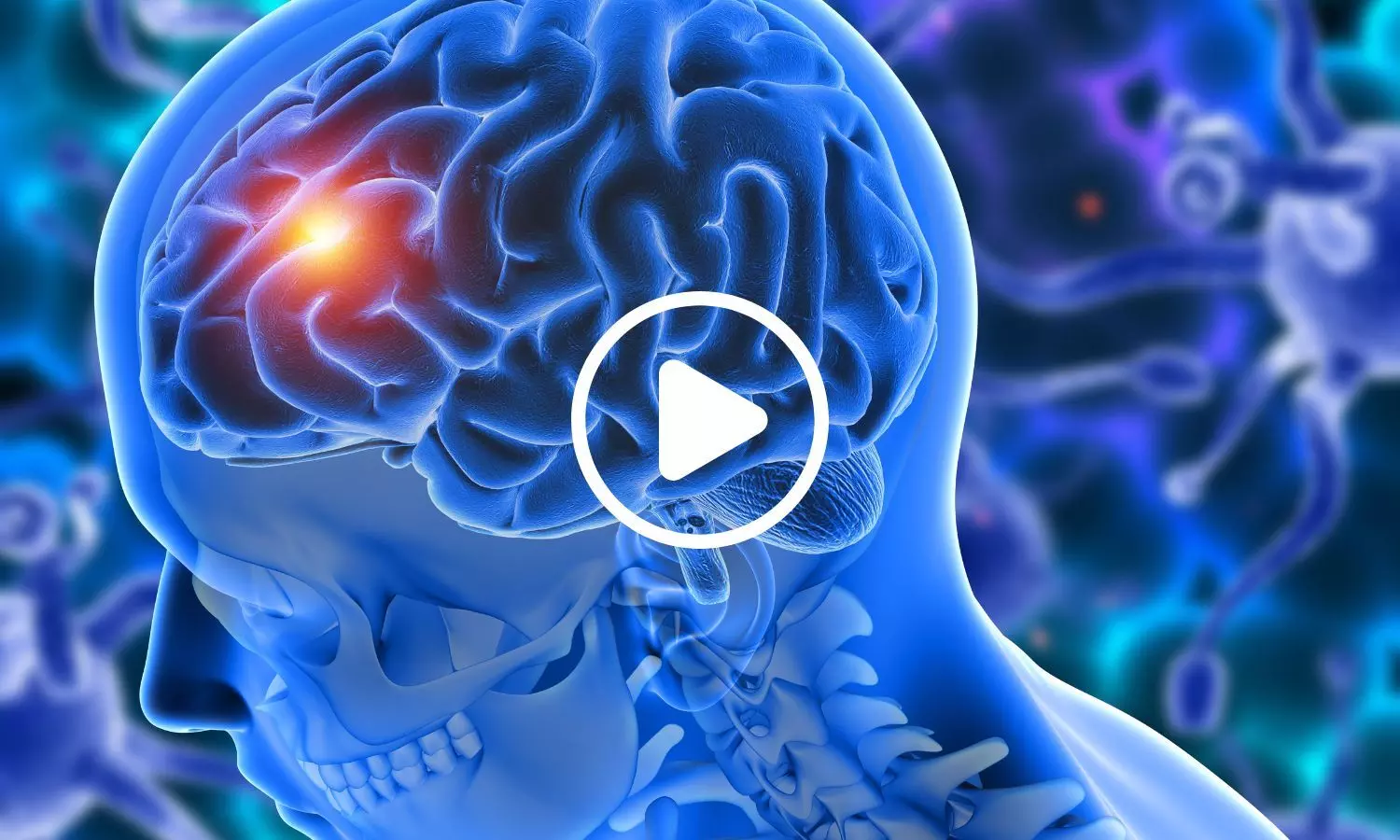 New Research Identifies Potential Target in One of the Deadliest Brain Tumours