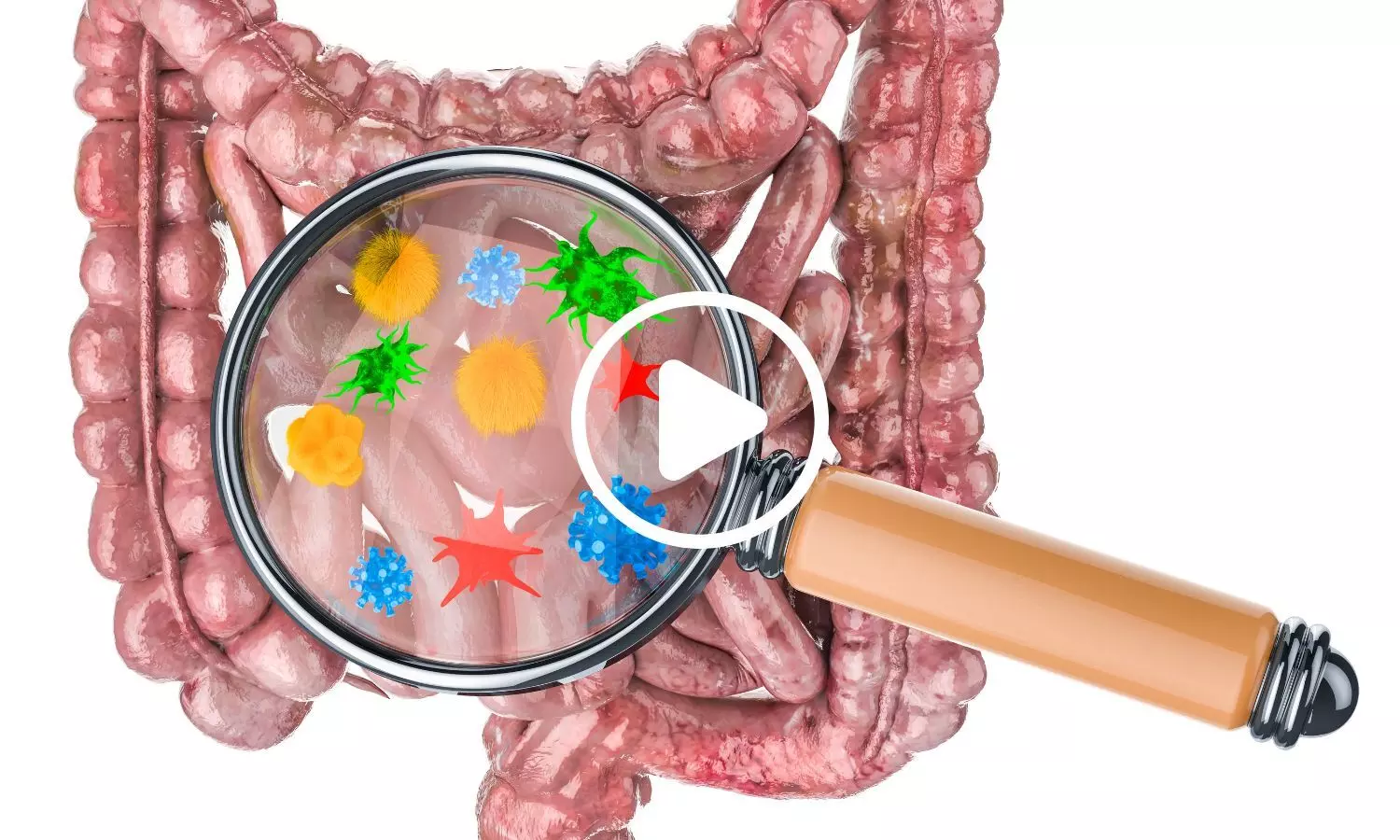 Gut Microbes May Spread Between People More Easily Than Scientists Expected: Study Gut Microbes May Spread Between People More Easily Than Scientists Expected: Study