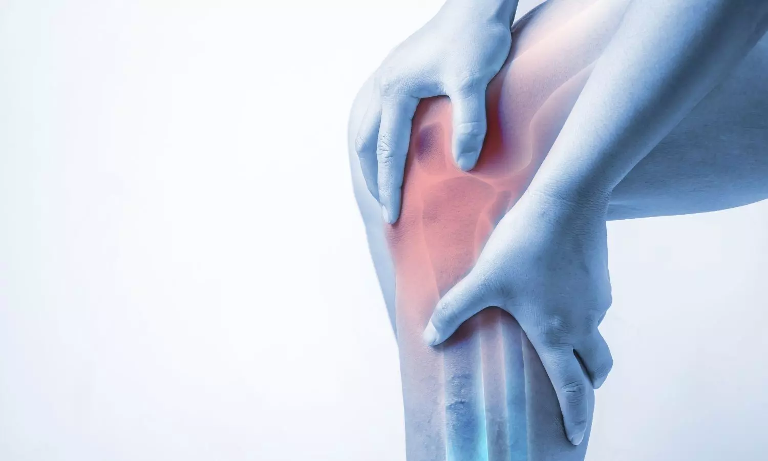 Medial Patellofemoral Ligament Reconstruction: A novel Non-implant Technique: Study