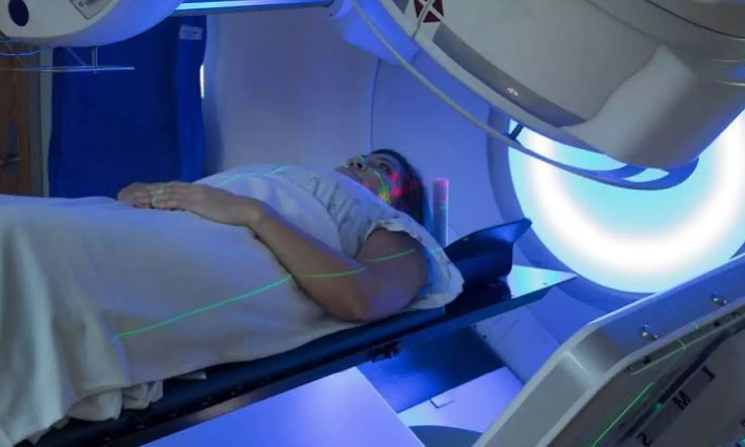 Radical Radiotherapy Use Nearly Doubled in Lung Cancer, Suggests Research Radical Radiotherapy Use Nearly Doubled in Lung Cancer, Suggests Research