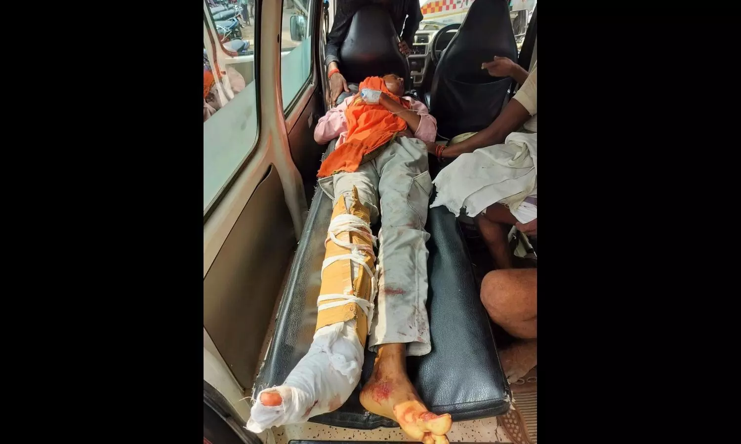 2 Patients With Fractures Referred to PMCH With Cardboard Splints 2 Patients With Fractures Referred to PMCH With Cardboard Splints