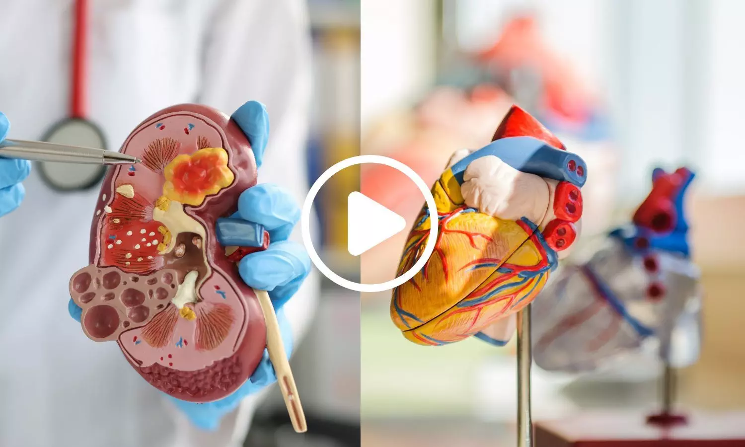 Proteomic Study Identifies Early Cardiovascular-Kidney-Metabolic Disease Signs in Children