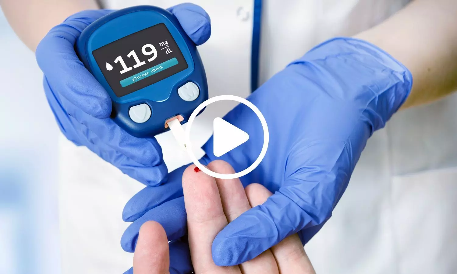 DASH Diet Tailored for Diabetes Improves Glycemic Control in Type 2 Diabetes: Study DASH Diet Tailored for Diabetes Improves Glycemic Control in Type 2 Diabetes: Study