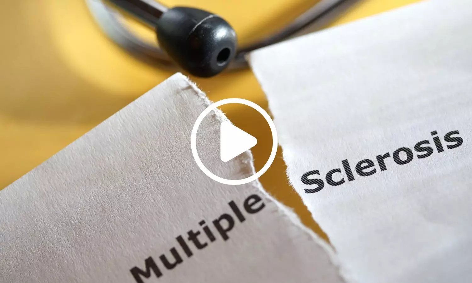 Single CAR-T Treatment Shows Promise for Relieving Multiple Sclerosis Symptoms, Trial Finds