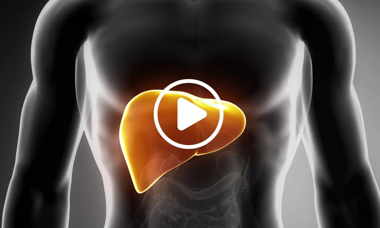 Study Identifies Bile Acid That May Reduce Excess Fat Accumulation in Liver Study Identifies Bile Acid That May Reduce Excess Fat Accumulation in Liver