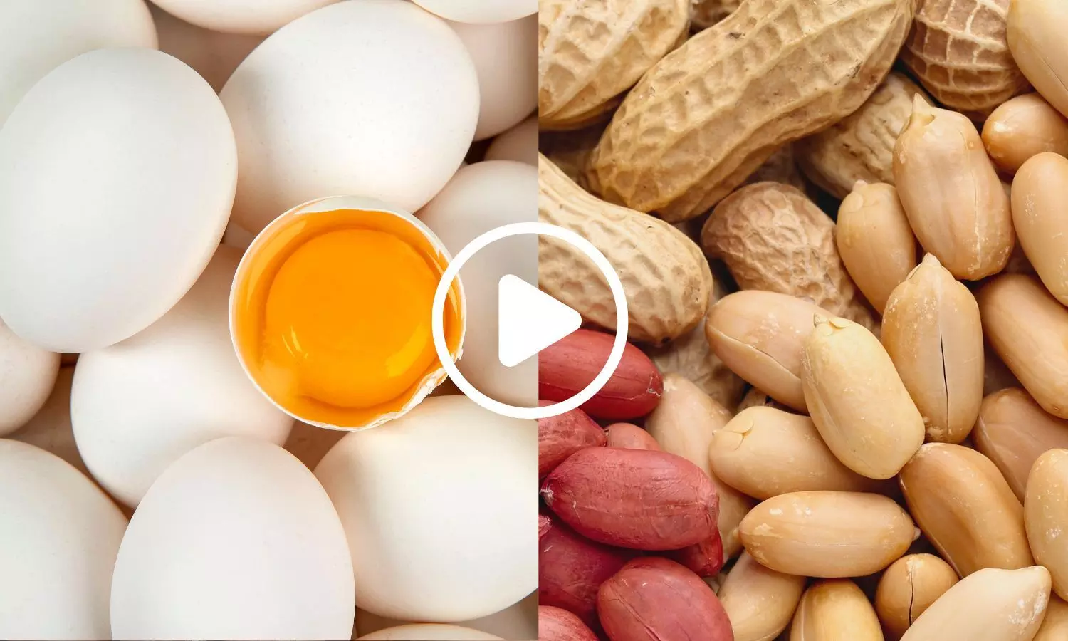 Large Trial Tests Whether Maternal Egg and Peanut Intake Prevents Infant Allergies