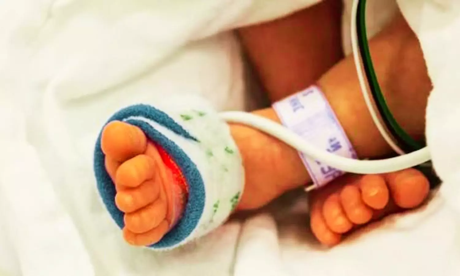 Renal Replacement Therapy Rare, Not Independently Linked to Higher Mortality in Children With VAD Placement: Study Renal Replacement Therapy Rare, Not Independently Linked to Higher Mortality in Children With VAD Placement: Study