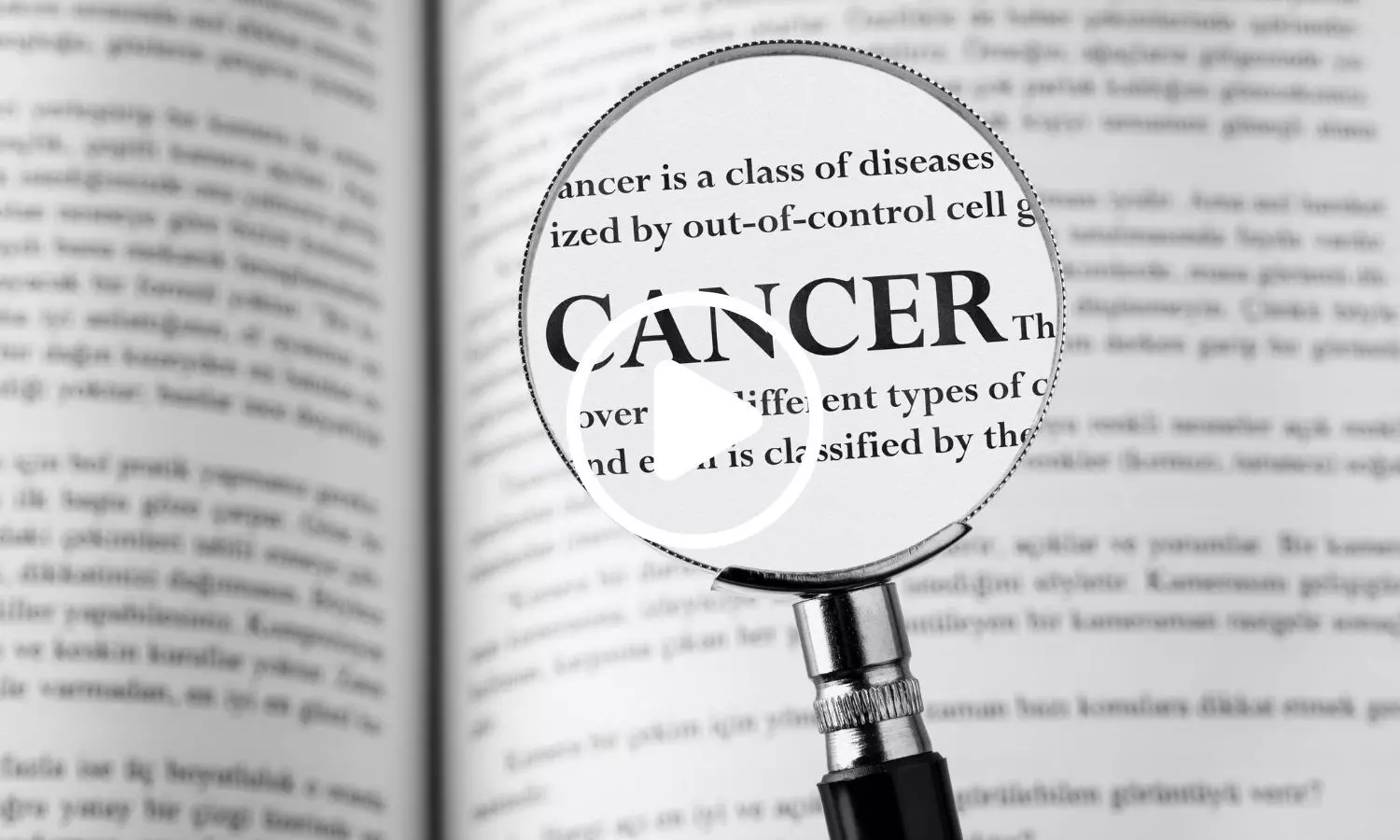 Loss of Y Chromosome May Provide Early Warning of Cancer in Men: Study