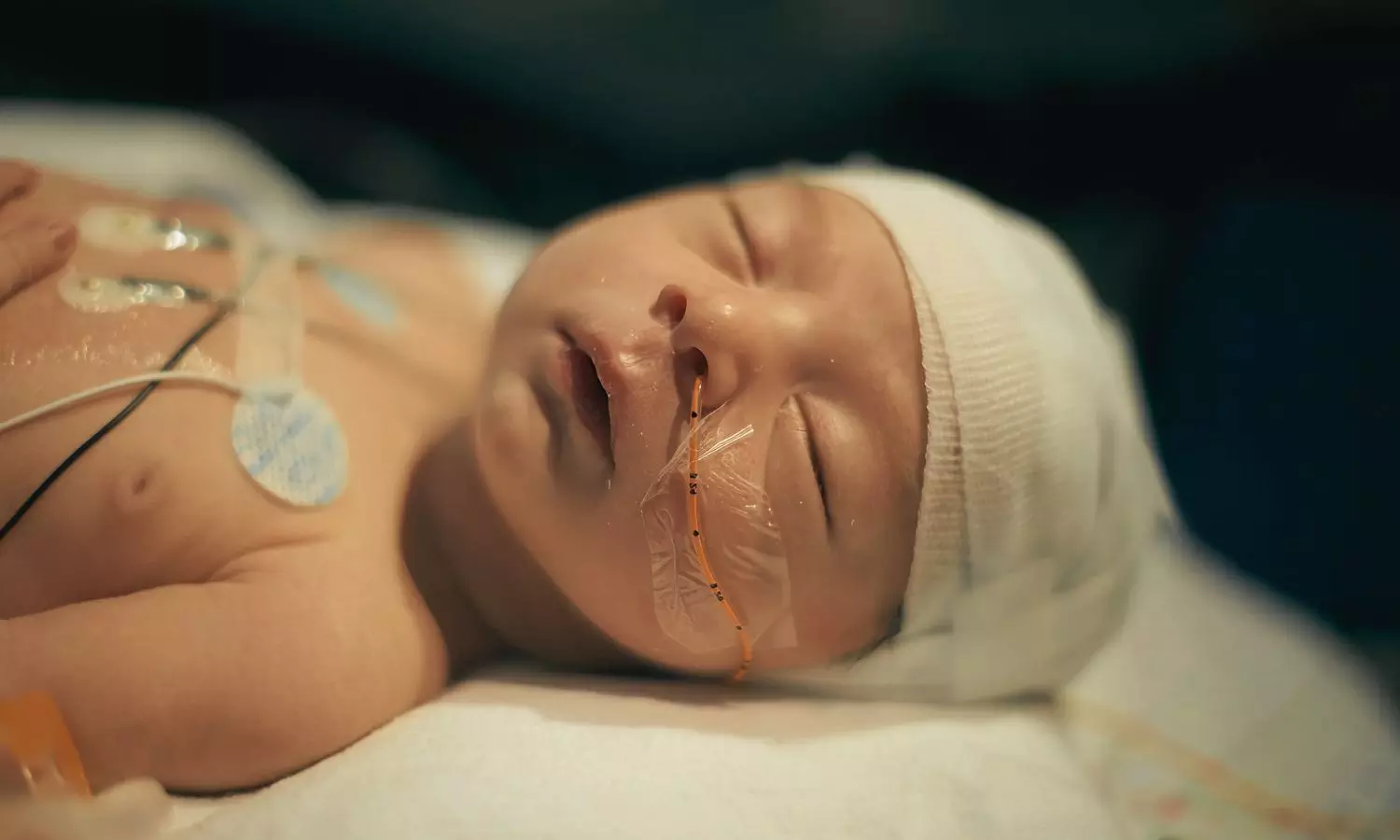 High-Dose Erythropoietin Does Not Improve Outcomes in Infants With HIE: JAMA High-Dose Erythropoietin Does Not Improve Outcomes in Infants With HIE: JAMA