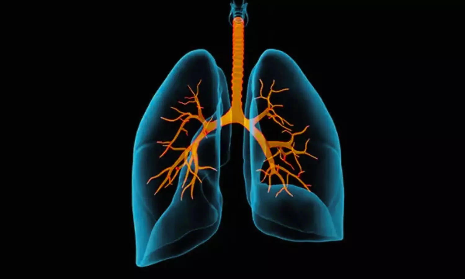 Dupilumab may Improve Asthma Control and Lung Function in Chinese Patients: Study Dupilumab may Improve Asthma Control and Lung Function in Chinese Patients: Study