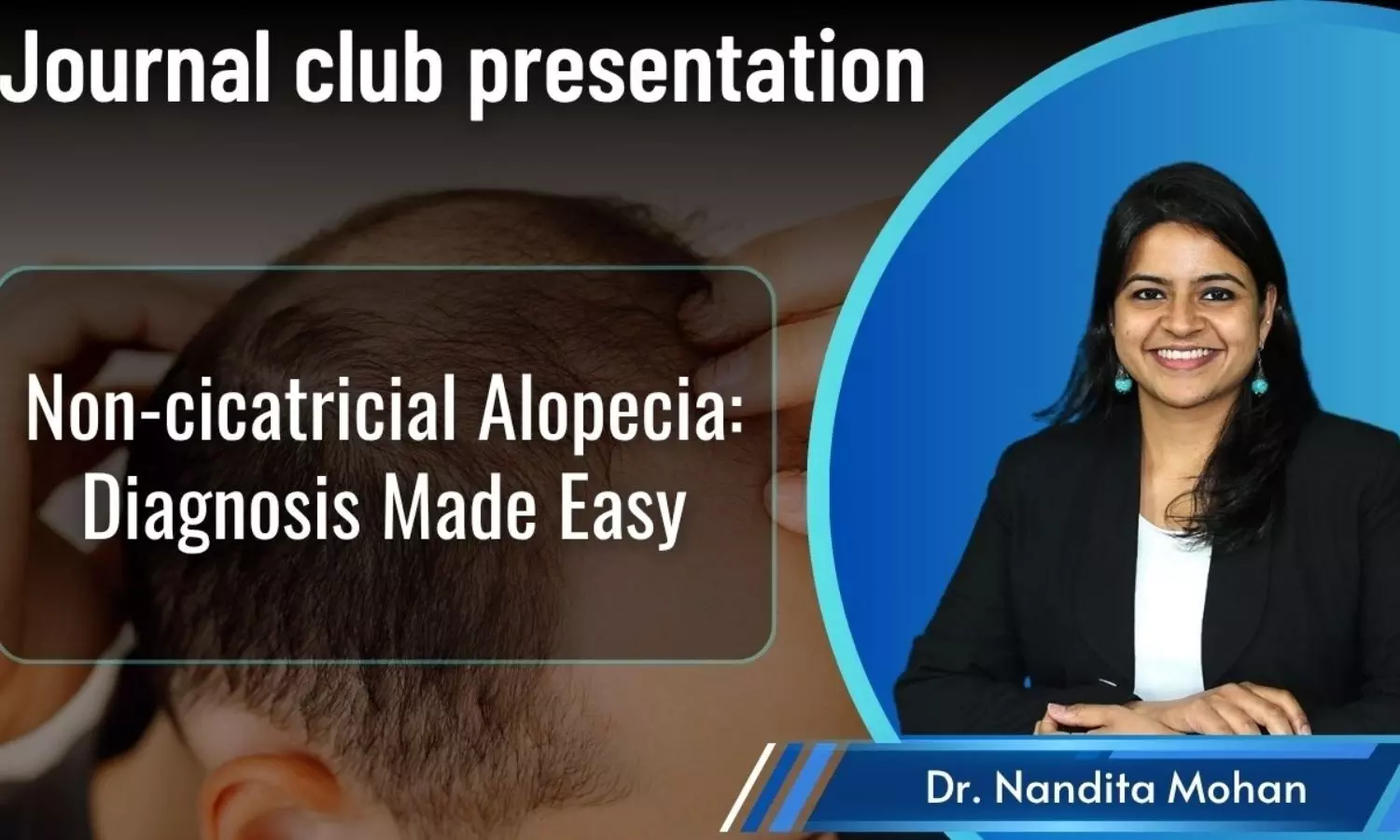 Journal Club- Non-cicatricial Alopecia: Diagnosis Made Easy Journal Club- Non-cicatricial Alopecia: Diagnosis Made Easy