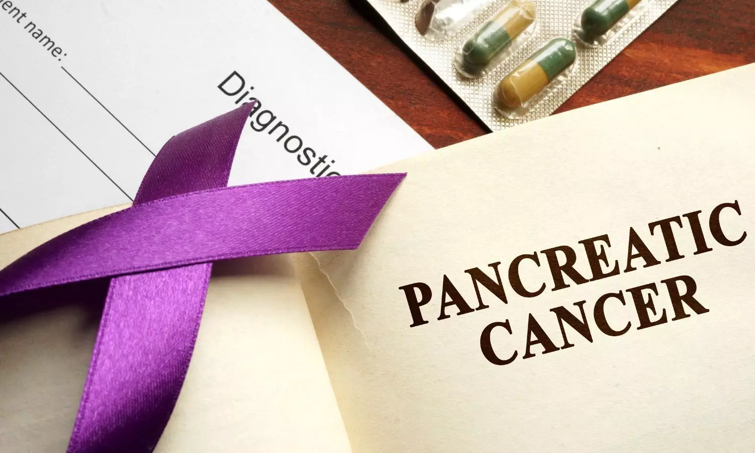 Mayo Clinic Researchers Develop AI Model That Predicts Pancreatic Cancer Risk Up to 3 Years Before Diagnosis