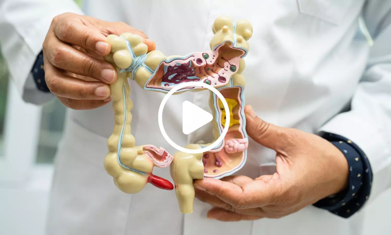New Study Reveals How Exercise May Alter Gut Microbes for Better Recovery New Study Reveals How Exercise May Alter Gut Microbes for Better Recovery