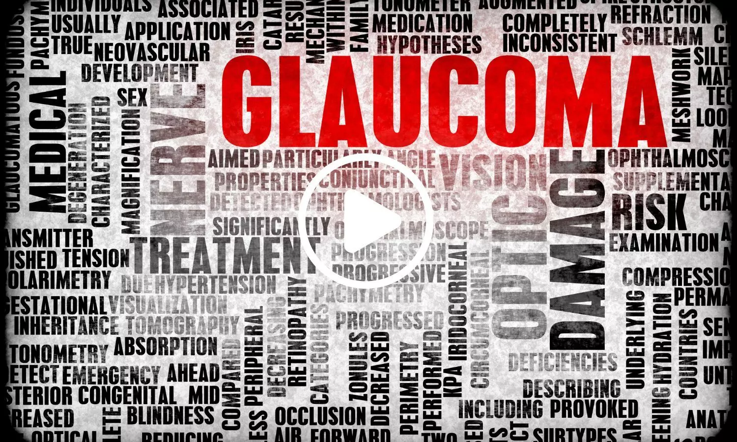 New Study Reveals Possible Protective Role of Statins Against Glaucoma New Study Reveals Possible Protective Role of Statins Against Glaucoma