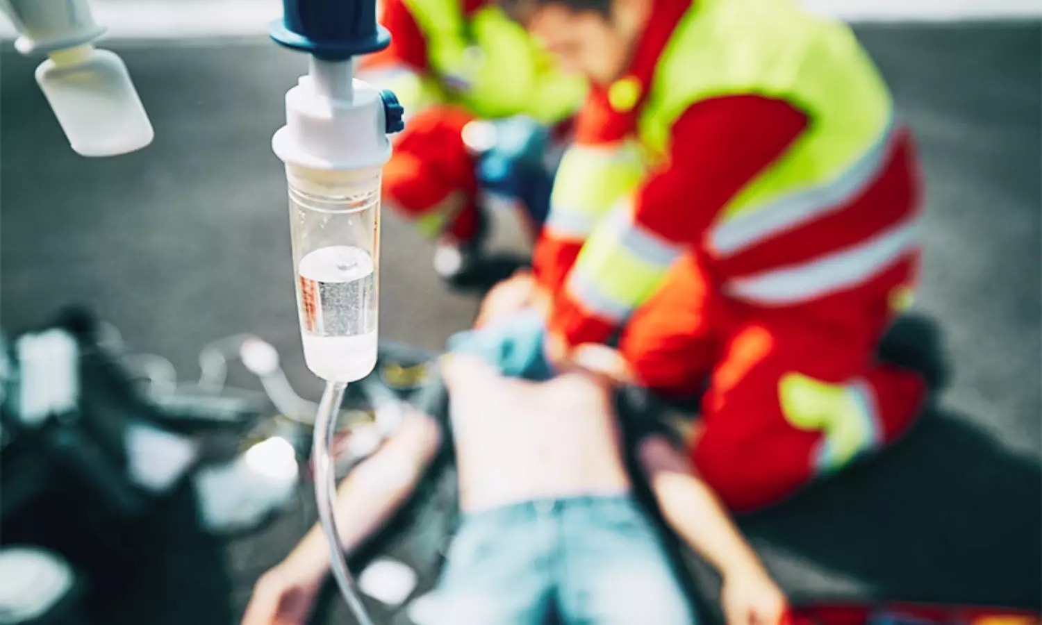 Prehospital Fluid Administration Not Linked to Mortality in Patients With Severe Burns: Study Prehospital Fluid Administration Not Linked to Mortality in Patients With Severe Burns: Study