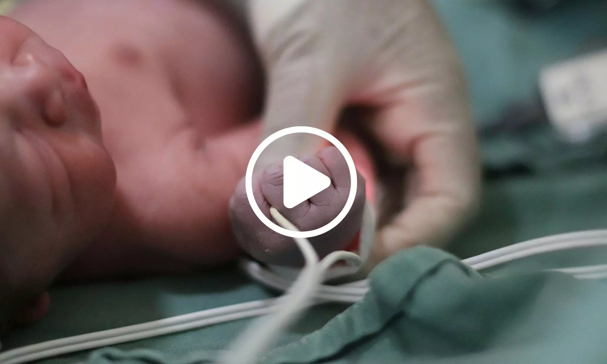 Autoantibodies May Be Linked to Higher Preterm Birth Risk in Some Women