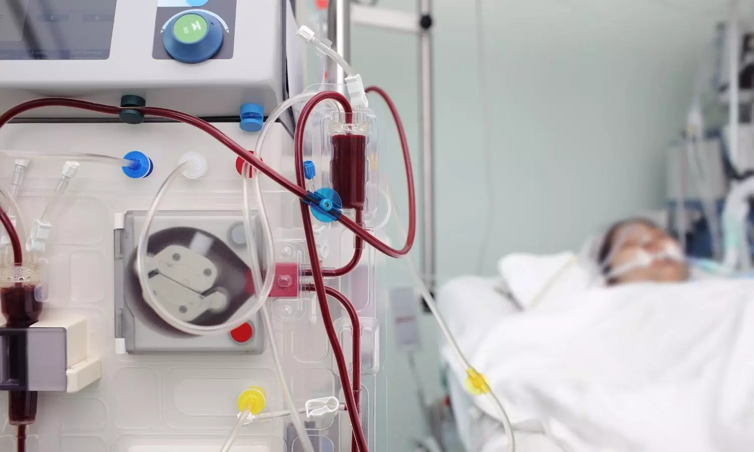 22 new dialysis centres to come up in Andhra Prdaesh 22 new dialysis centres to come up in Andhra Prdaesh