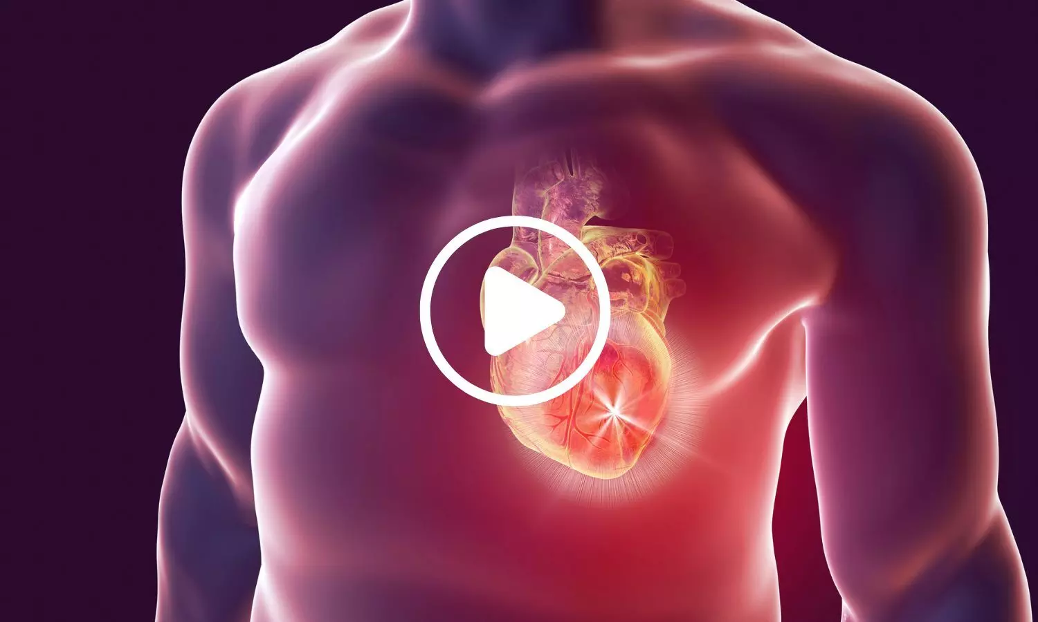 New Recommendations Call for Exercise to Be Central to Heart Disease Management
