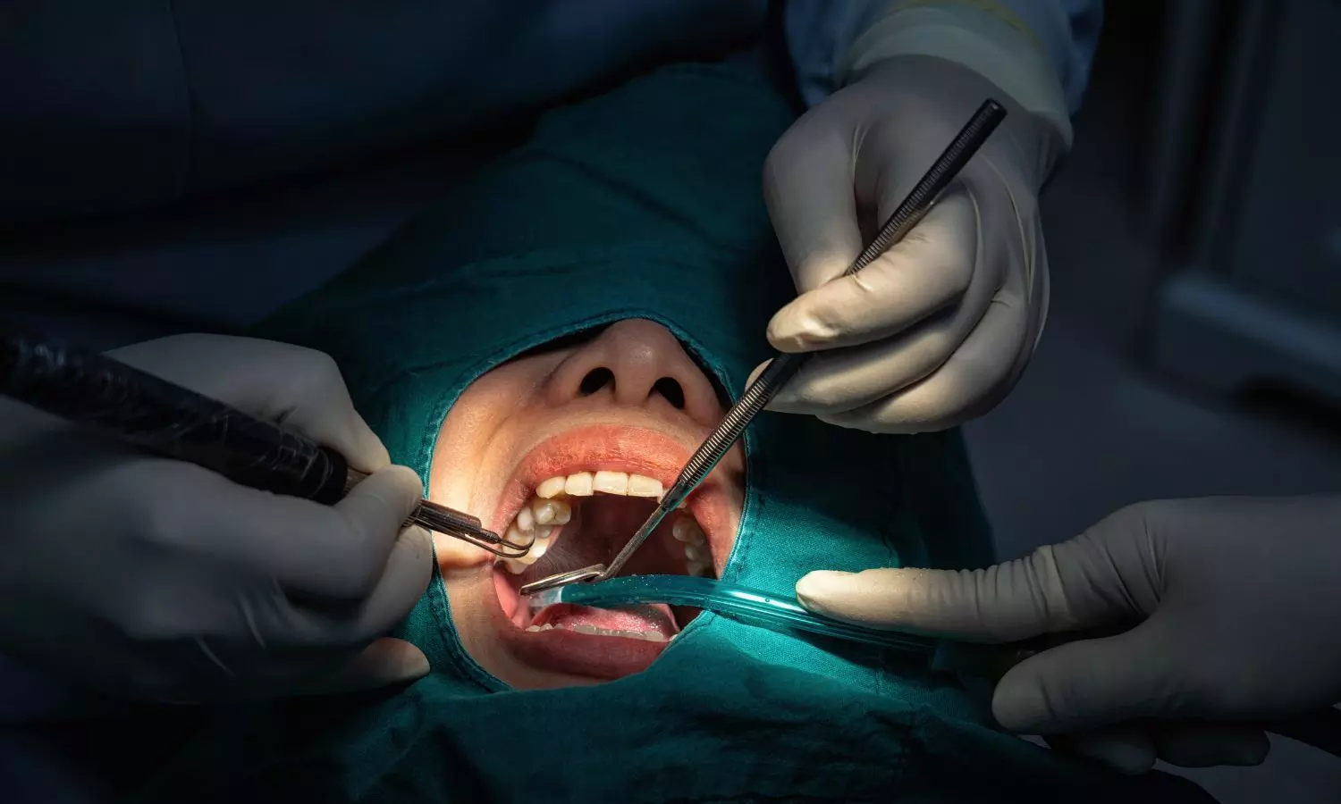 Surgery May Preserve Condylar Height and Improve Degenerative Changes in ADDWoR of TMJ: Study Surgery May Preserve Condylar Height and Improve Degenerative Changes in ADDWoR of TMJ: Study