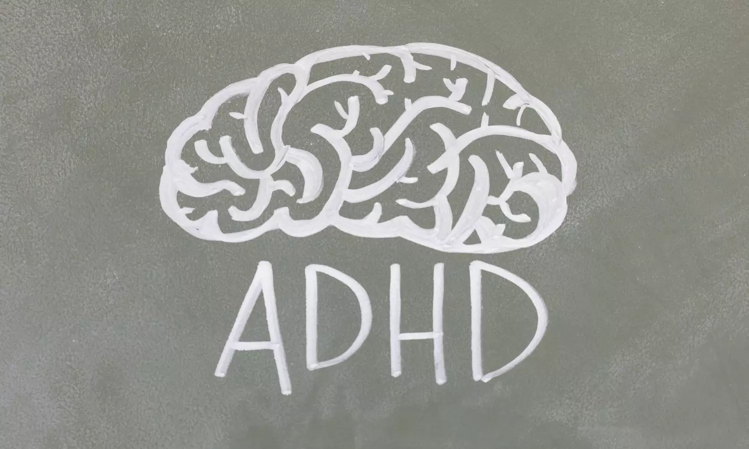 ADHD linked to higher mortality but medication may help: JAMA ADHD linked to higher mortality but medication may help: JAMA