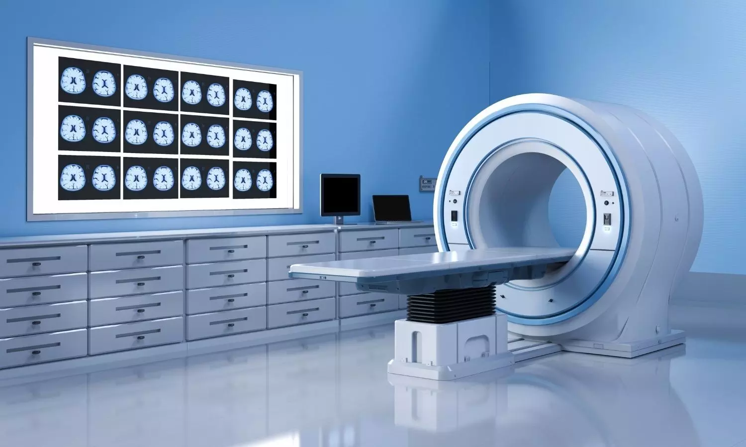 CT scans, MRI tests to cost 20 percent below CGHS rates at 3 MCD Hospitals CT scans, MRI tests to cost 20 percent below CGHS rates at 3 MCD Hospitals