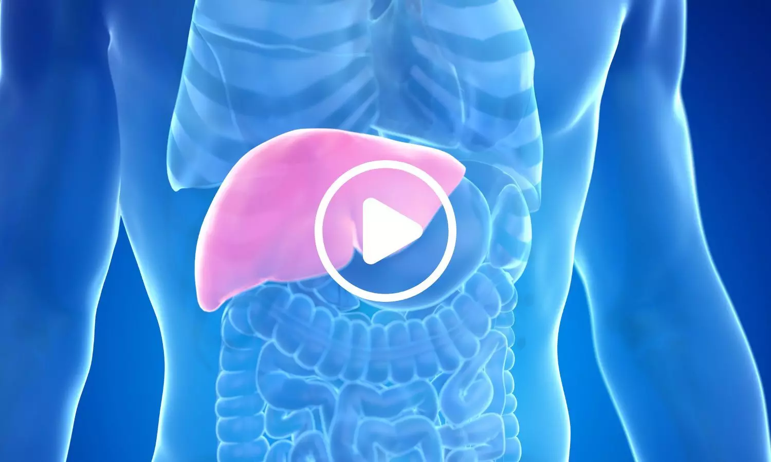 Scientists Discover Fatty Liver Disease May Consist of Five Distinct Conditions