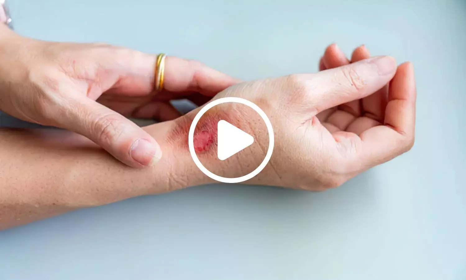 Not All Skin Is the Same: Study Reveals Differences Between Male and Female Skin Not All Skin Is the Same: Study Reveals Differences Between Male and Female Skin