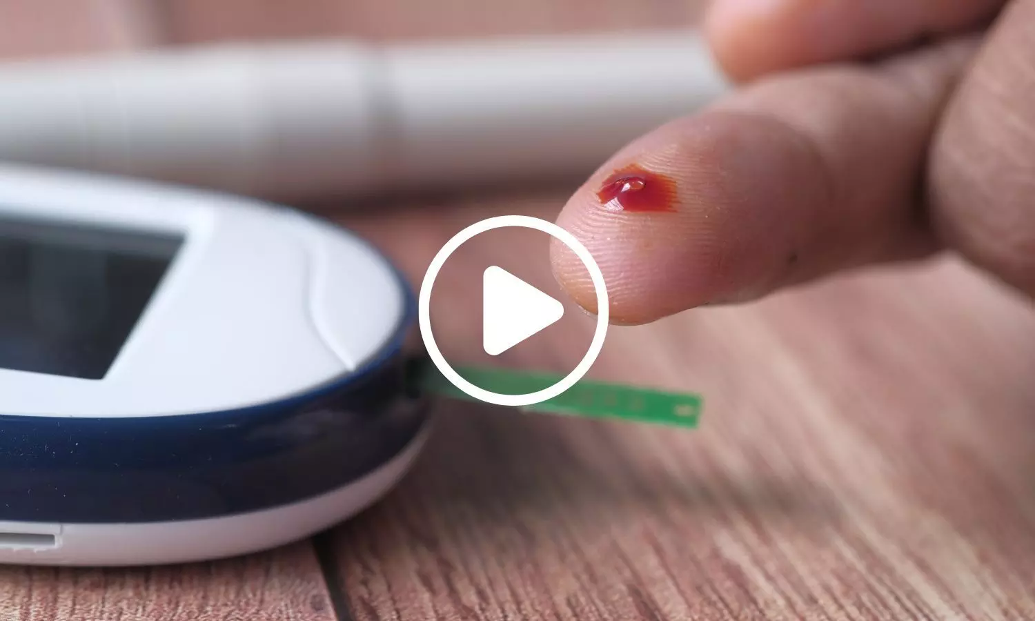 Scientists Develop $10 Chip That Could Enable Needle-Free Blood Glucose Monitoring in New Study
