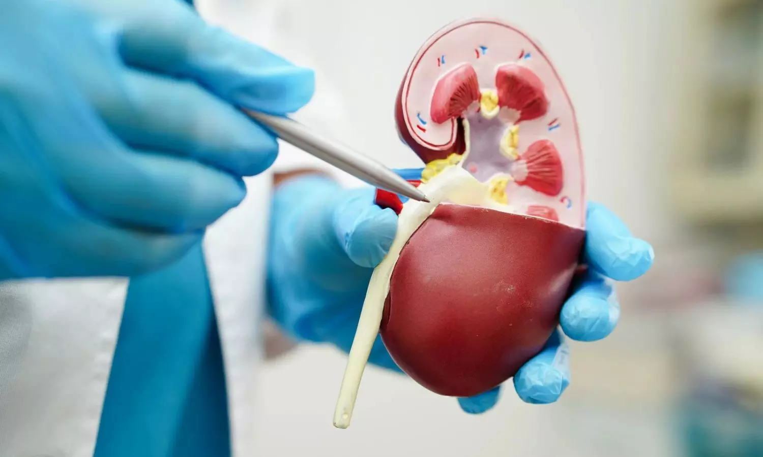 Tegoprubart Improves QoL After Kidney Transplant Compared with Tacrolimus, suggests study Tegoprubart Improves QoL After Kidney Transplant Compared with Tacrolimus, suggests study