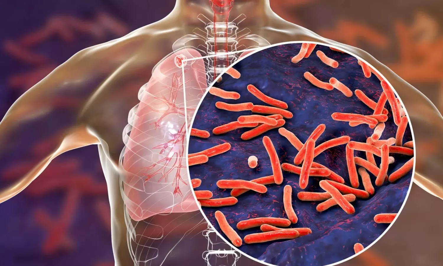 AI can boost early detection of tuberculosis and lung cancer, says Dr Randeep Guleria