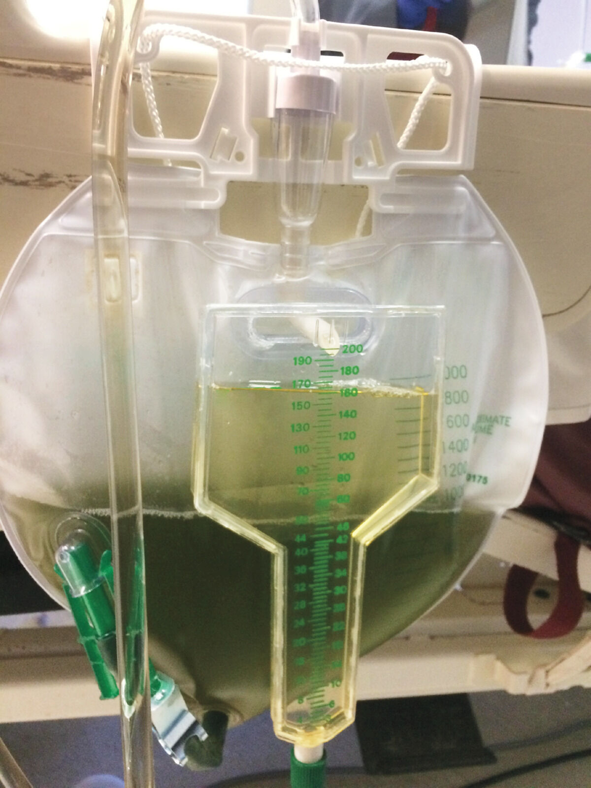 Rare case of green urine reported in NEJM