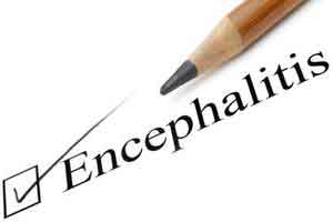 50 people reported dead in West Bengal due to Encephalitis