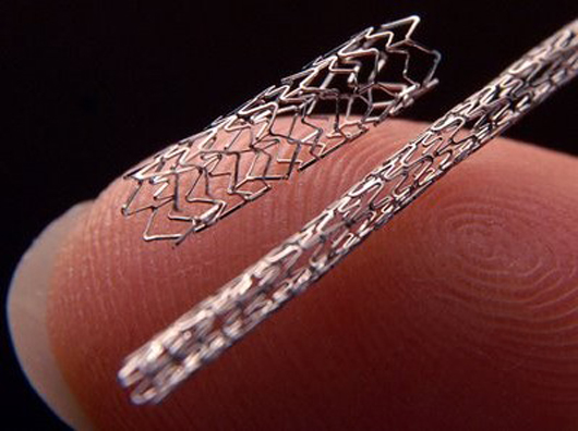 New DES stents to be introduced to the Indian market soon