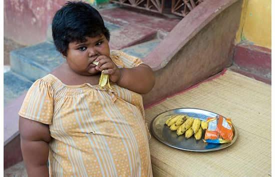 Obese kids as young as 8 show signs of heart disease