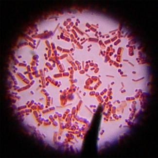 Himachal Pradesh: Bacterial disease Scrub Typhus claims 4 lives