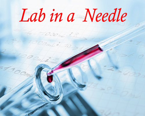Researchers developing lab in a needle device for quick diagnostic testing