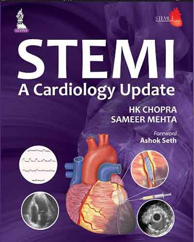 Indian Cardiologists to release STEMI update