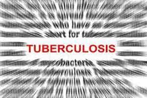 Nagaland fails to reach target of TB elimination for absence of doctors