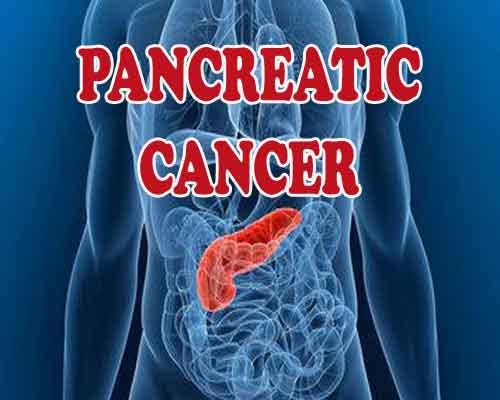 New Test to Quickly Spot Pancreatic Cancer: Study