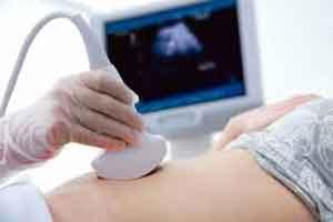 Ultrasound Can Identify People at High Stroke Risk