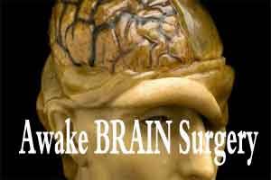 Hypnosis offers new alternative for awake brain surgery