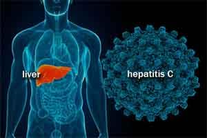 New medicine for Hepatitis C treatment launched