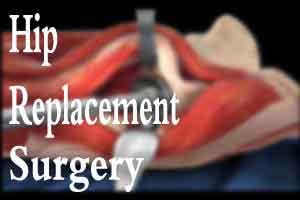 J&K: 72 BPM Healthcare performs complicated hip replacement surgery