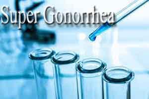 Antibiotic resistance putting super gonorrhea at untreatability risk